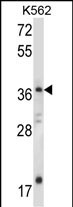 WB - JMJD6 Antibody (C-term) AP14160b